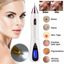 Anti-Aging Laser Plasma Pen Mole Removal Dark Spot Skin Tag Tattoo Wart Remover