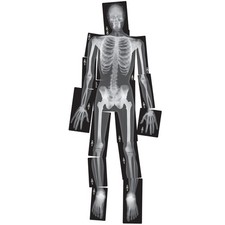 Royclo Human X-Rays on Film - 18 Pieces