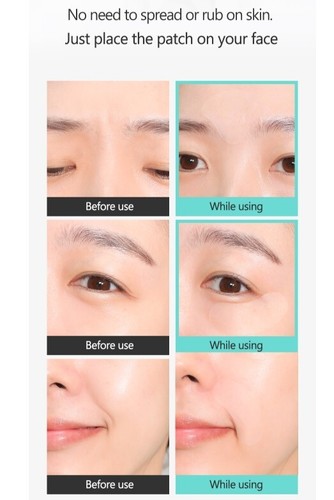 RIRE Smile Wrinkle Patch 200pcs Line Lifter Eyebrow Care Korean Skin Care NEW - Picture 7 of 21