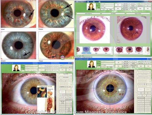 Gráfico de cámara de iridología 2025 12 MP HD 30X iriscopio U9811 análisis CCD de iris V 3,31 - Imagen 15 de 15