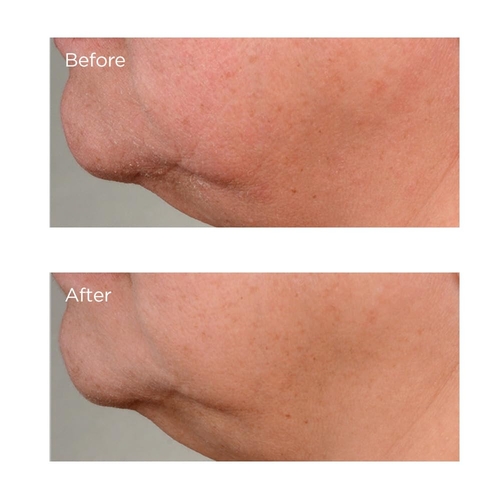 High Potency Growth Factor Firming & Lifting Serum, 2 Fl. Oz. - Picture 2 of 5