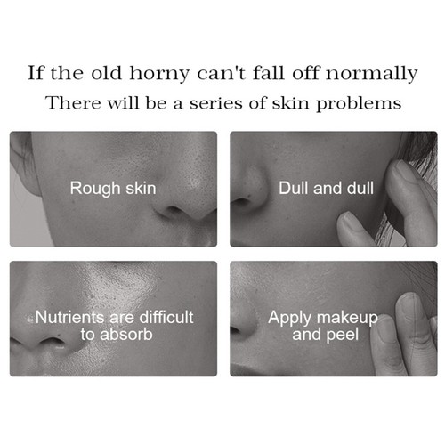 AICHUN BEAUTY Gel Esfoliante Viso Corpo Rimuove Pelle Invecchiamento Pulizia Profonda 100ml - Foto 21 di 95