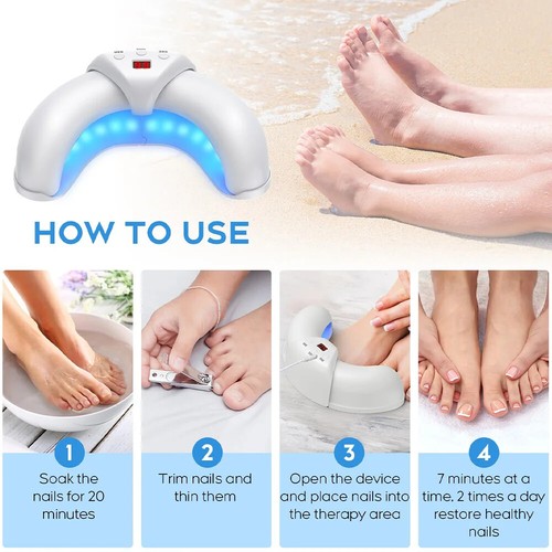 Toenail Fungus Light Device Treatment Therapy Okita Style Toe Nail Onychomycosis - 第 3/7 張圖片
