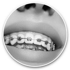 2 x Vinyl Stickers 30cm (bw) - Orthodontist Teeth Braces  #38561