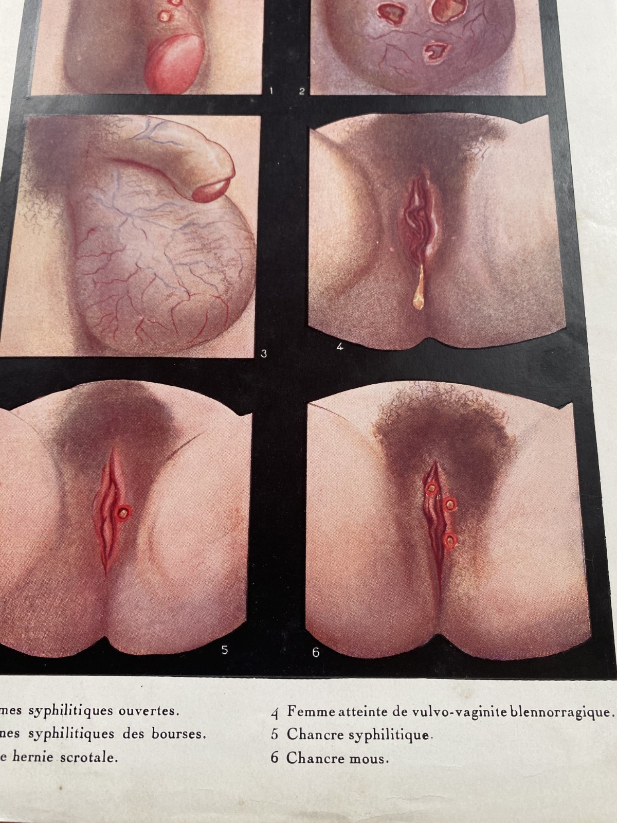 Imagen 3 de 5