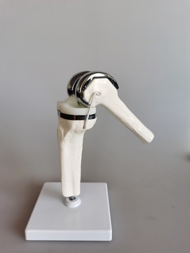 Detachable Artificial Knee Prosthesis Medical Anatomical Teaching Demo Display - Picture 6 of 15