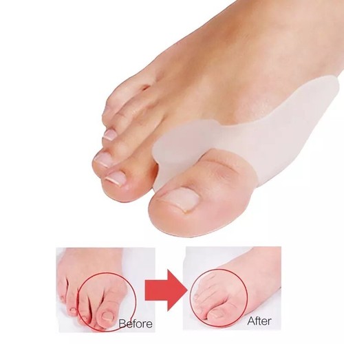 1 PAAR SILIKON ZEHENTRENNER FUSS HALLUX VALGUS KORRIGIERUNG KNOCHEN✅JVG-067⭐ - Bild 4 von 6