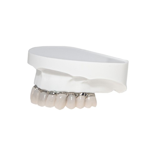 Dental Implant All-on-4 Overdenture Restoration Model Upper Jaw 4 Screws M6023 - Picture 8 of 13