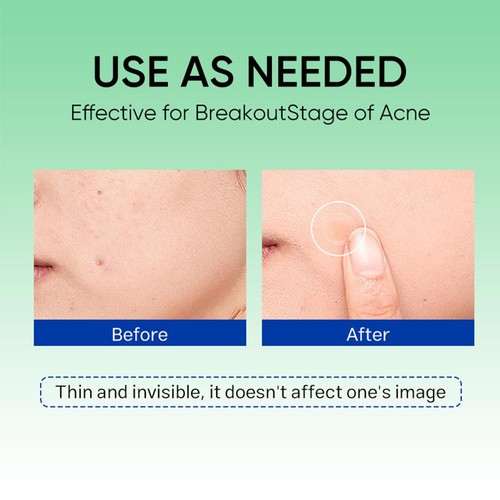 6 Patches Microneedle Acne Pimple Healing Patch Anti Acne Pimple Patch Soothing - Picture 7 of 9