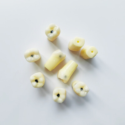 Dental Molar Vitro Teeth Decay Caries Tooth Model Dentist Student School Test