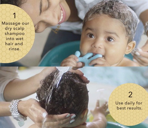 BELLA B Bee Gone Cradle Cap Baby Shampoo Treatment, 8 oz, Organic Natural Dry - Picture 5 of 7