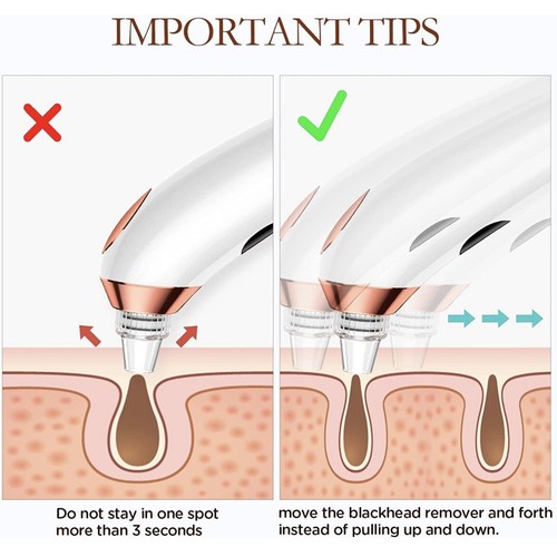 Color Light Blackhead Remover Vacuum Pore Cleaner Facial Acne Pimple Tools - Picture 2 of 3