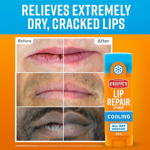 Lip Repair Lip Balm with Cooling Relief for Dry - Picture 2 of 4