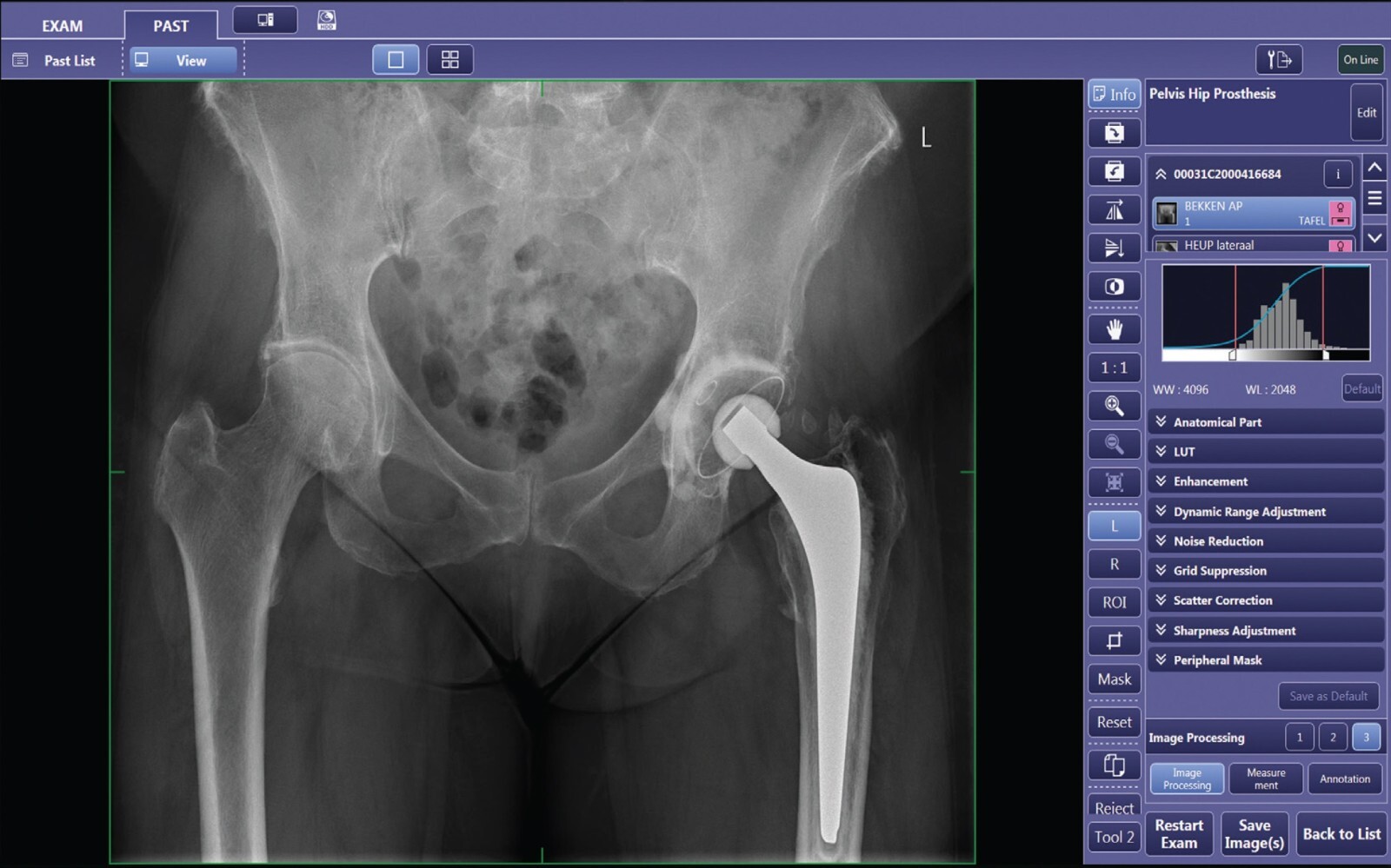 Imagen 4 de 7