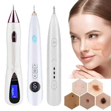 Laser Plasma Pen Mole Removal Dark Spot Skin Tag Tattoo Mole Wart Remover Pen