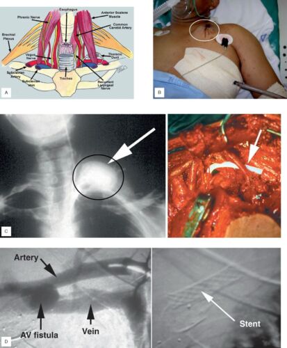 Chest Wounds Trauma Surgery Gunshot Stab Bizarre Medical Anatomy Autopsy ER EMT - Imagen 2 de 3