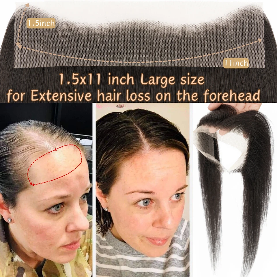 CLEARANCE Women FULL Lace Hairline Topper Toupee Frontal Hairpiece 8A Human Hair - Image 3 of 4