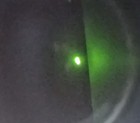 Foto 7 di 18