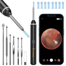 VITCOCO WiFi Otoscope, 1920P HD Ear Scope with 8 Ear Spoons for All Devices