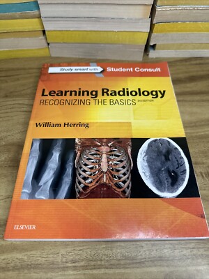 Learning Radiology: Recognizing The Basics, 3e Paperback