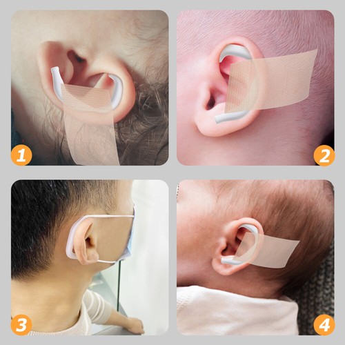 5 Pairs ear corrector for Baby Ear Aesthetic Corrector Auricle Support Tools - Picture 5 of 12