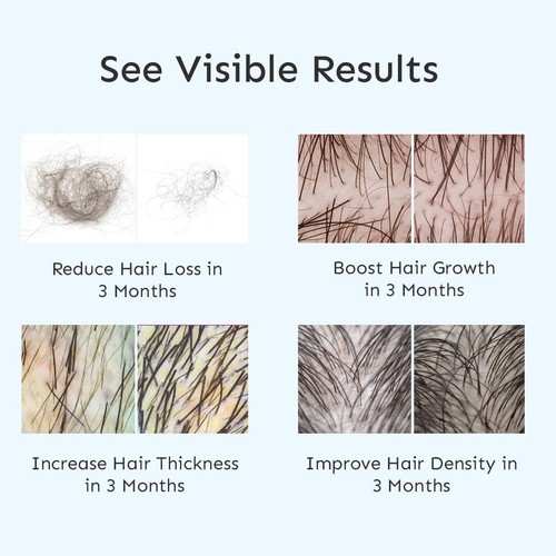 2X ARATA Intensive Haarwuchs Serum - 3% Redensyl, 3% Procapil | 2X30ml - Bild 6 von 8