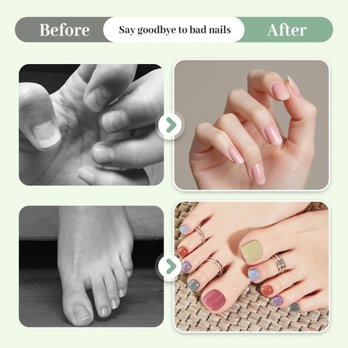 Nail Care Pen Nagelpilz Stift, 2025 Neu Nagelpilz Stift Österreich - Bild 17 von 42