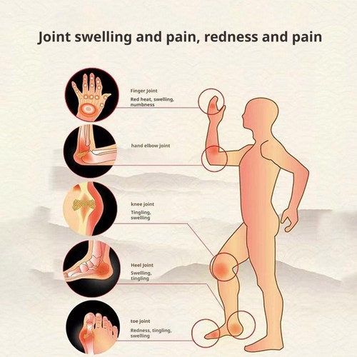 6 Pcs Gout Relief Patch for Gout and Joint Pain Relieves Redness Swelling Heat - Picture 12 of 14