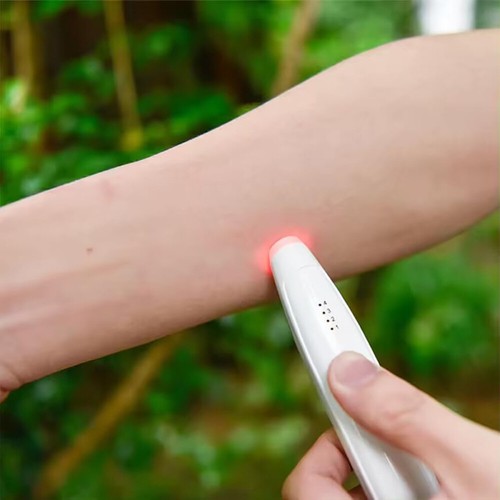 Insektenstich Heiler Anti Mückenstich Juckreiz Hitze Stift verstellbare Stufen - Bild 14 von 18