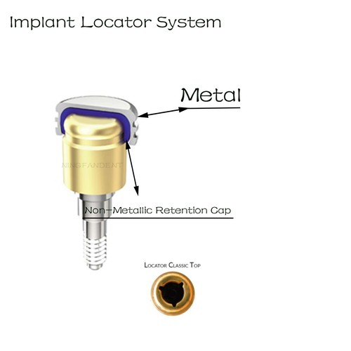 Conjunto de carcasa metálica y tapa de laboratorio de repuesto para localizador dental de 20 piezas - Imagen 4 de 4