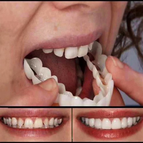 Zahnprothese Zahnersatz Kosmetische künstliches Prothese Falsche Gebiss Zähne - Bild 7 von 10