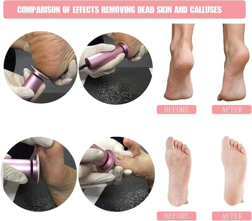 Elektrische Fußfeile Hornhautentferner Profi 60 Stück (1er Pack), schwarz  - Bild 2 von 8