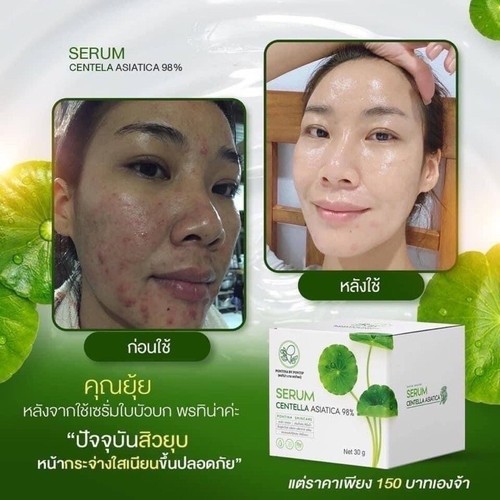 6x30g Porntina Centella Asiatica Serum Moisturized Soothe Skin By Irritation - Picture 16 of 20