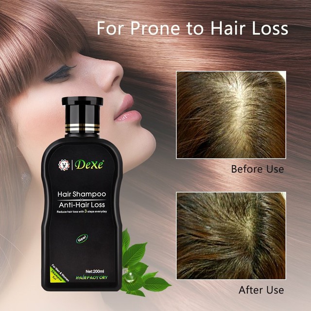 Shampoo Para La Caida Del Cabello ACELERA El Crecimiento