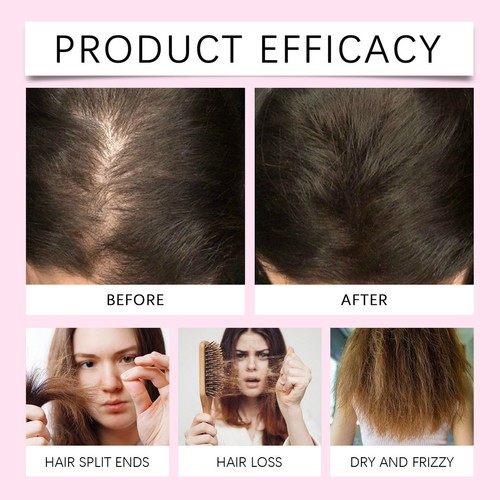 1~12X Hair Helper Spray Hair Growth Thicker Vegan Fuller Healthier Hair Treatmen - Picture 2 of 21
