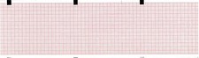 ECG Paper 80MM X 90MM X 360Sheet (Works for HELLIGE CONTRAST, MAC 400, PK 5