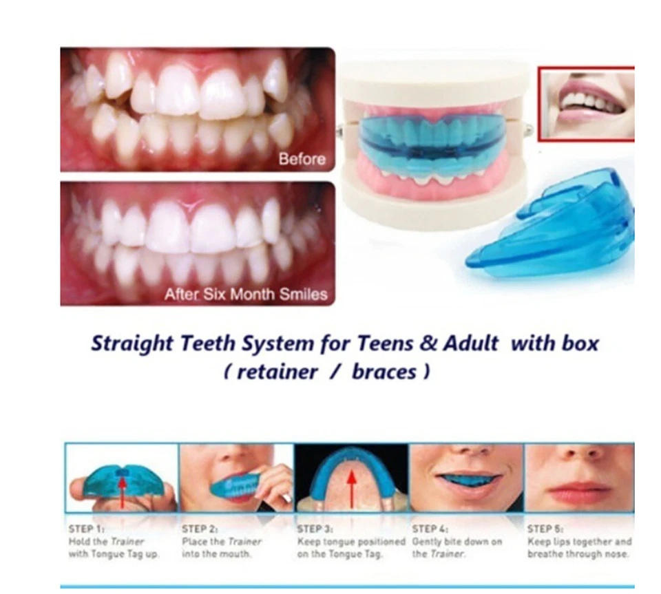 Silicone Dental Mouth Guard Bruxism Guard Night Teeth Tooth Grinding Sleep Aid - Image 3 of 4
