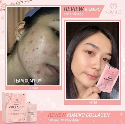 6x Kumiko Collagen Premium 150.000 mg Vitamin strahlende jugendliche aufhellende Haut - Bild 11 von 13