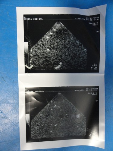 Toshiba PSK-20CT Phased Array Ultrasound Probe for SSA-380 & Powervision (7276) - Picture 12 of 12