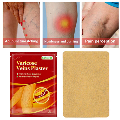 6pcs Varicose Veins Plaster Vasculitis Phlebitis Spider Leg Medical Patch - Picture 8 of 13