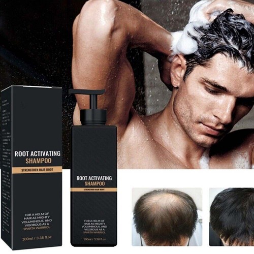 New Root Activator Shampoo, Natural Hair Regrōwth Hair Loss Shampoos - Picture 2 of 14