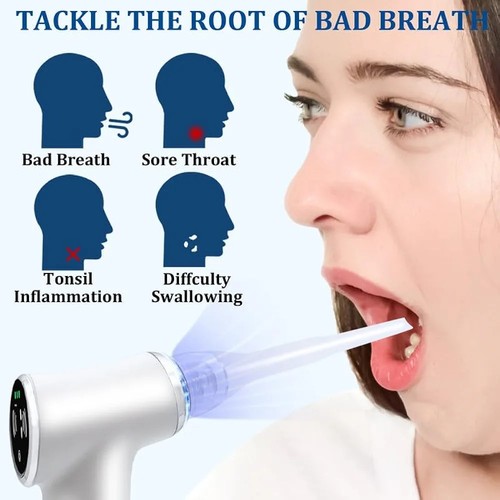 Tonsil Stone Vacuum System Removal Kit with LED Light Type-C Charging - Picture 5 of 5