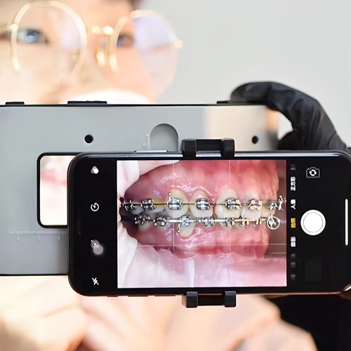 Dental LED Oral Photography Oral Supplementary Lamp With Bracket Filling Light - Picture 5 of 16