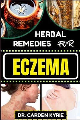 Herbal Remedies for Eczema: Unlocking Nature's Healing Power With Herbs For Flou