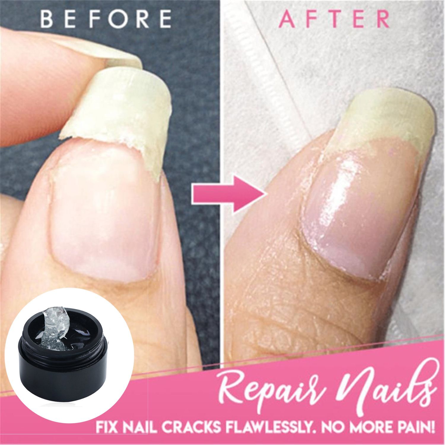 Nails Instant Cracked Nail Repair Gel Fix Nail Cracks Nail Nail Strengthener | eBay Nails Instant Cracked Nail Repair Gel Fix Nail Cracks Nail Nail Strengthener | eBay