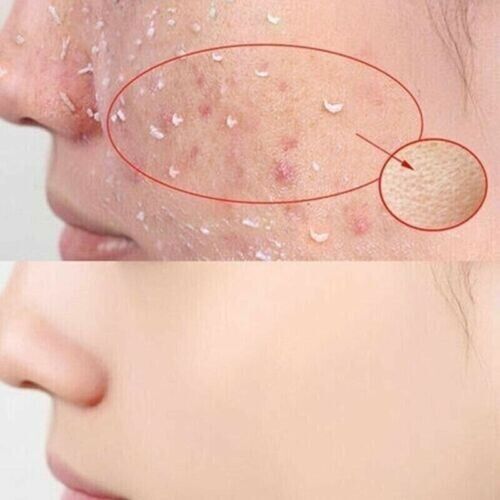 FACE & BODY CLEANSING SCRUB GEL FENG CLEAN EXFOLIANTE GEL HENG FNG 100ML - Picture 4 of 4