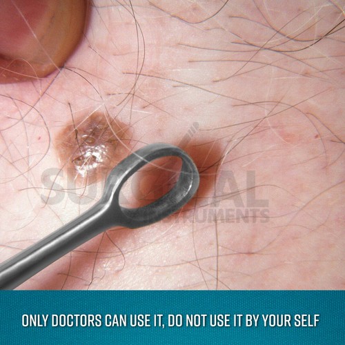 Fox Dermal Curette 2mm Surgical Dermatology Instruments German Grade - Bild 8 von 8