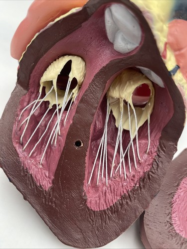 ESP ZKJ-642-W Heart Enlarged, Flexible Anatomical Model Heart Anatomy Aorta - Picture 3 of 10