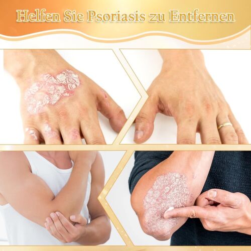BSOON Bee Venom Gel 3Pcs Bienengift Creme Psoriasis Professional Bee Venom Ointm - Bild 6 von 6