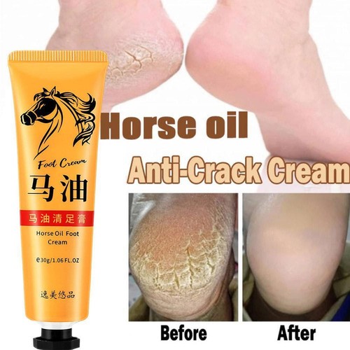 Horse Oil Foot Cream Crack Heel Remover Cream Foot Moisturizing Q4W3 J7R2 D4P6